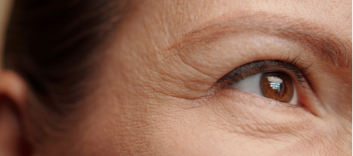 Combattere le rughe con l'argirelina: proprietà e benefici