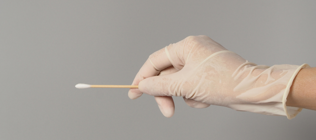 Tampone per lo streptococco: a cosa serve e quando è indicato
