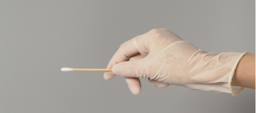Tampone per lo streptococco: a cosa serve e quando è indicato