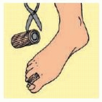 S109LF DIGI-STRIP TUB C/GEL L